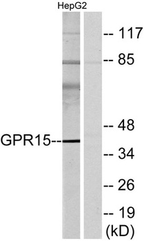 GPR15 rabbit pAb Antibody