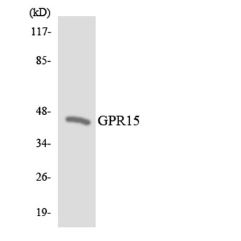 GPR15 rabbit pAb Antibody