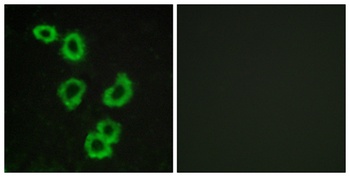 GPR176 rabbit pAb Antibody