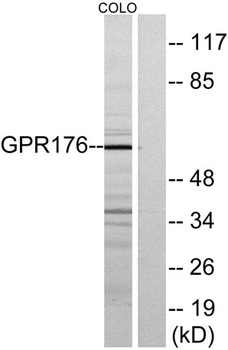 GPR176 rabbit pAb Antibody