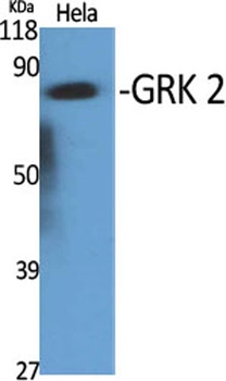 GRK 2 rabbit pAb Antibody