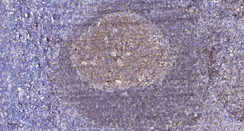 GRK 3 rabbit pAb Antibody