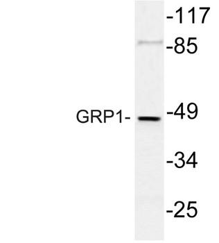 GRP1 rabbit pAb Antibody