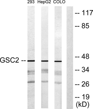 GSC2 rabbit pAb Antibody