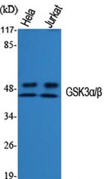 GSK3α/β rabbit pAb Antibody