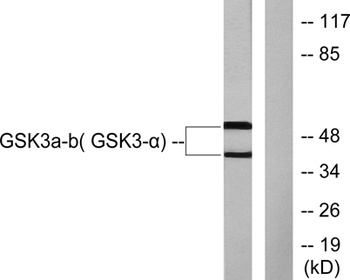 GSK3α/β rabbit pAb Antibody