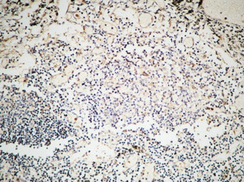 GTBP rabbit pAb Antibody