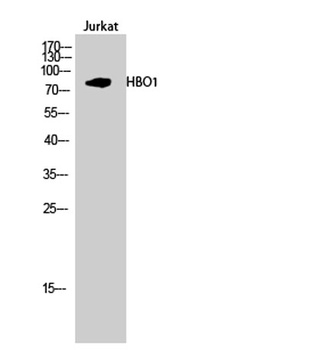HBO1 rabbit pAb Antibody