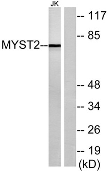 HBO1 rabbit pAb Antibody
