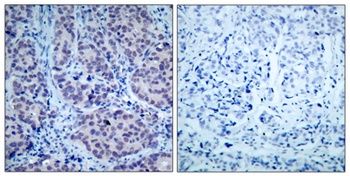 HDAC2 rabbit pAb Antibody