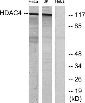 HDAC4 rabbit pAb Antibody