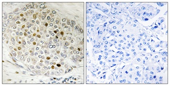 HDAC5 rabbit pAb Antibody