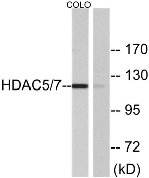 HDAC5 rabbit pAb Antibody