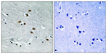 HDAC6 rabbit pAb Antibody