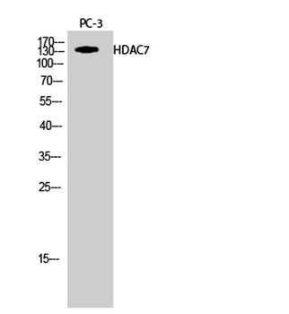HDAC7 rabbit pAb Antibody