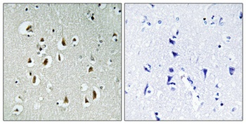 HEI10 rabbit pAb Antibody