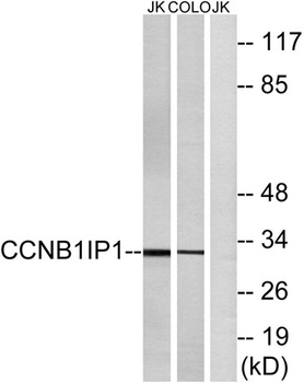HEI10 rabbit pAb Antibody
