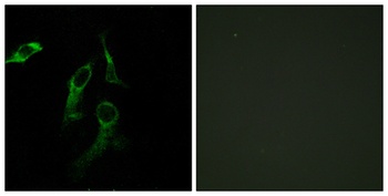 HisRS rabbit pAb Antibody