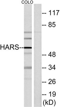 HisRS rabbit pAb Antibody