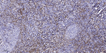 HisRS rabbit pAb Antibody