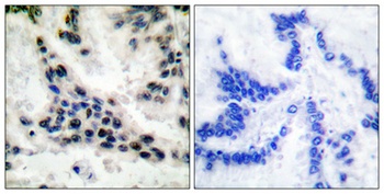 Histone deacetylase 1 rabbit pAb Antibody