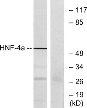 HNF-4α rabbit pAb Antibody