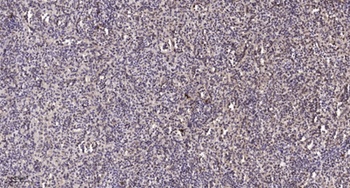 HNF-4α rabbit pAb Antibody