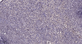 HNF-4α/γ rabbit pAb Antibody