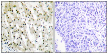 hnRNP A1 rabbit pAb Antibody