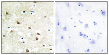 hnRNP C1/C2 rabbit pAb Antibody