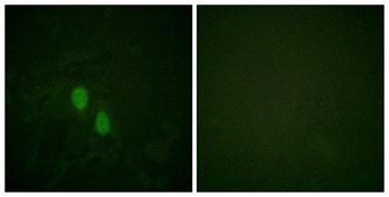 hnRNP D0 rabbit pAb Antibody