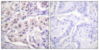 hnRNP D0 rabbit pAb Antibody