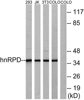 hnRNP D0 rabbit pAb Antibody