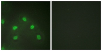 hnRNP L rabbit pAb Antibody