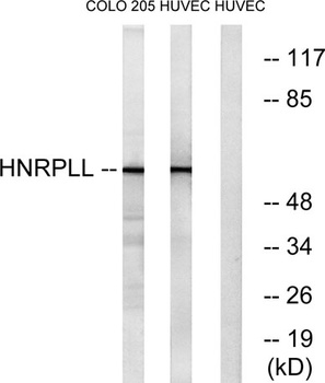 hnRNP LL rabbit pAb Antibody
