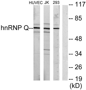 hnRNP Q rabbit pAb Antibody