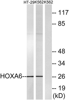 HoxA6 rabbit pAb Antibody