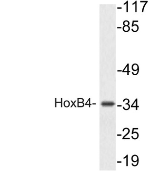 HoxB4 rabbit pAb Antibody