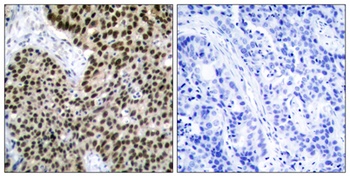 HSF1 rabbit pAb Antibody