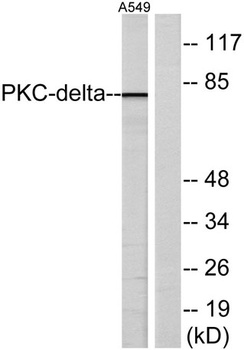 HSF1 rabbit pAb Antibody