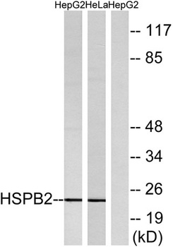 HSP β2 rabbit pAb