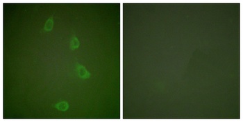 HSP40 rabbit pAb Antibody
