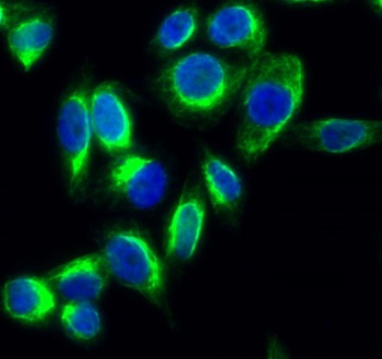 HSP60 rabbit pAb Antibody
