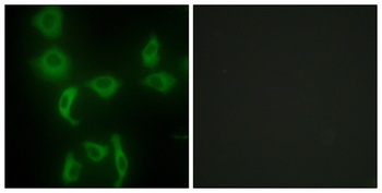 IARS2 rabbit pAb Antibody