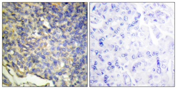 ICAD rabbit pAb Antibody