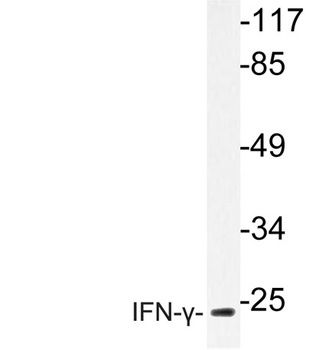 IFN-γ rabbit pAb Antibody