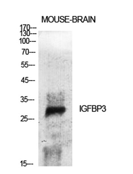 IGFBP3 rabbit pAb Antibody
