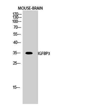 IGFBP3 rabbit pAb Antibody
