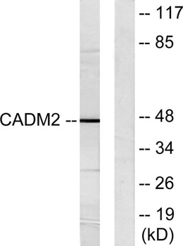 IGSF4D rabbit pAb Antibody