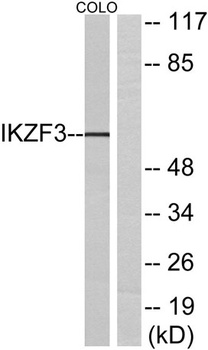 Ikaros 3 rabbit pAb Antibody